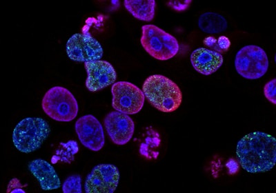 New Production Line for Milk Thistle Extract Launched